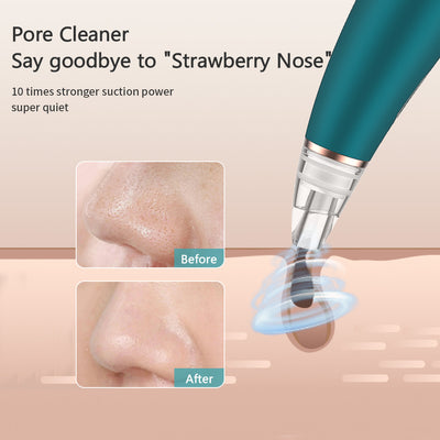 Blackhead Remover & Bubble Pore Cleanser | New Generation Deep Cleansing Tool